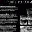Рентгенологическое исследование в стоматологии - Лунинский район